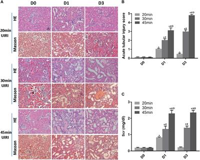 Ischemic Duration and Frequency Determines AKI-to-CKD Progression Monitored by Dynamic Changes of Tubular Biomarkers in IRI Mice